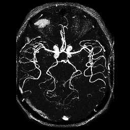 MRI-angiografa axial